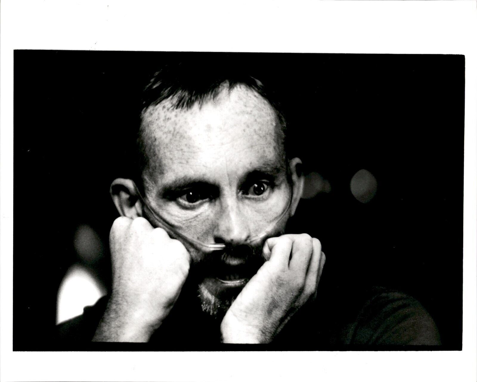 LG23 1987 Original Doug Menuez Photo FACES OF THE AIDS EPIDEMIC Patient Air Tube