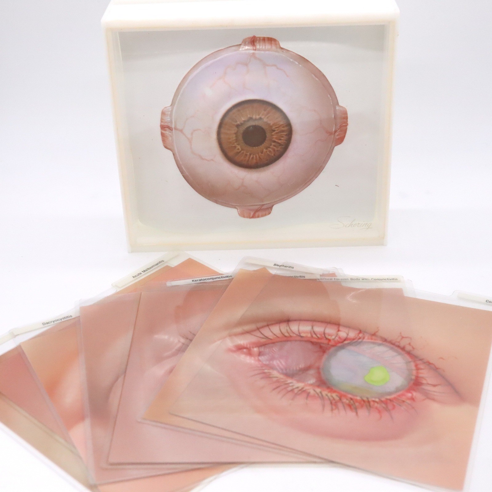 Vtg Schering Ophthalmology Eye Disease Medical Teaching Aid Slide Set Anatomy