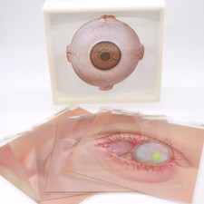Vtg Schering Ophthalmology Eye Disease Medical Teaching Aid Slide Set Anatomy picture